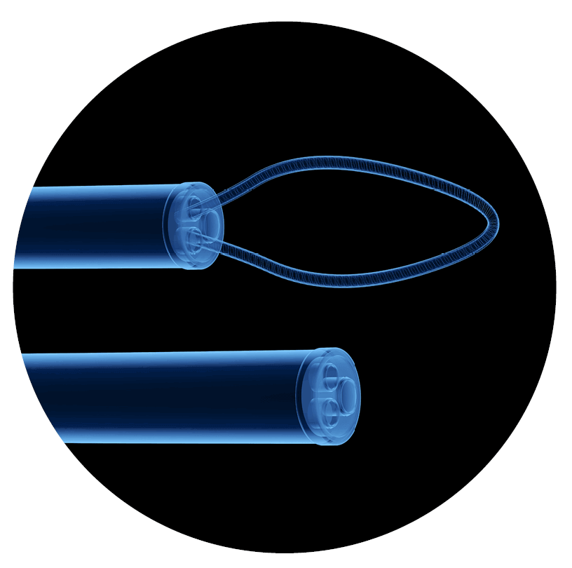 Advanced Minimally Invasive Bile Duct Surgery Endoscope