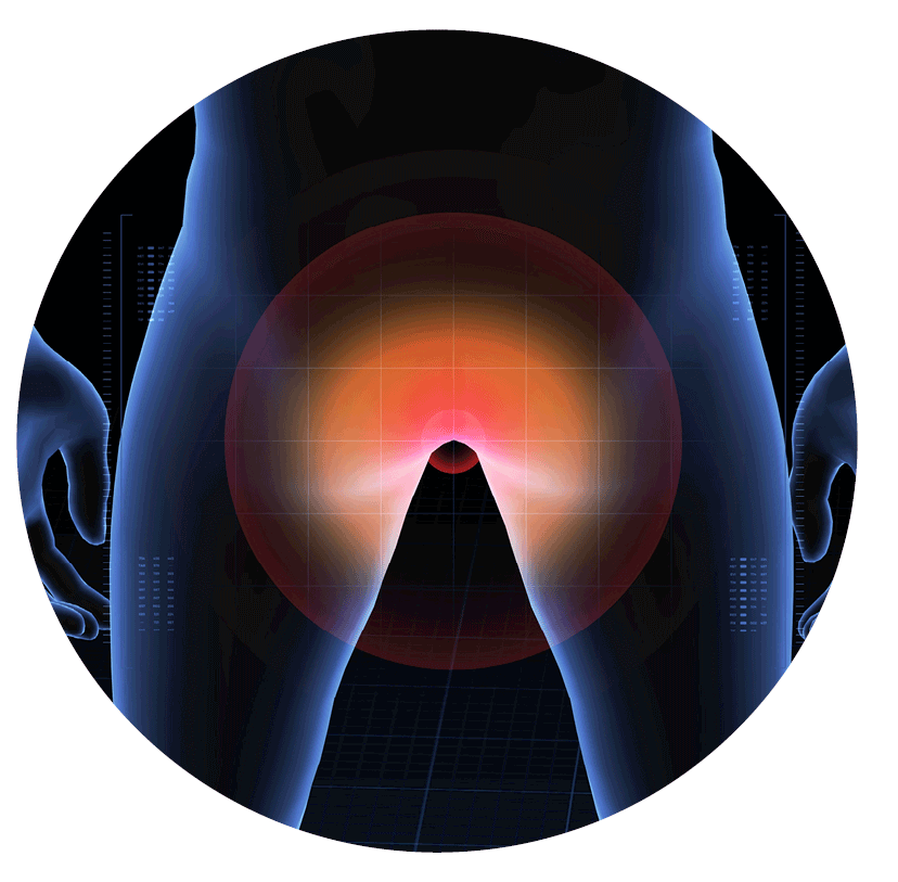 Trans-Anal Minimally Invasive Surgery Torso